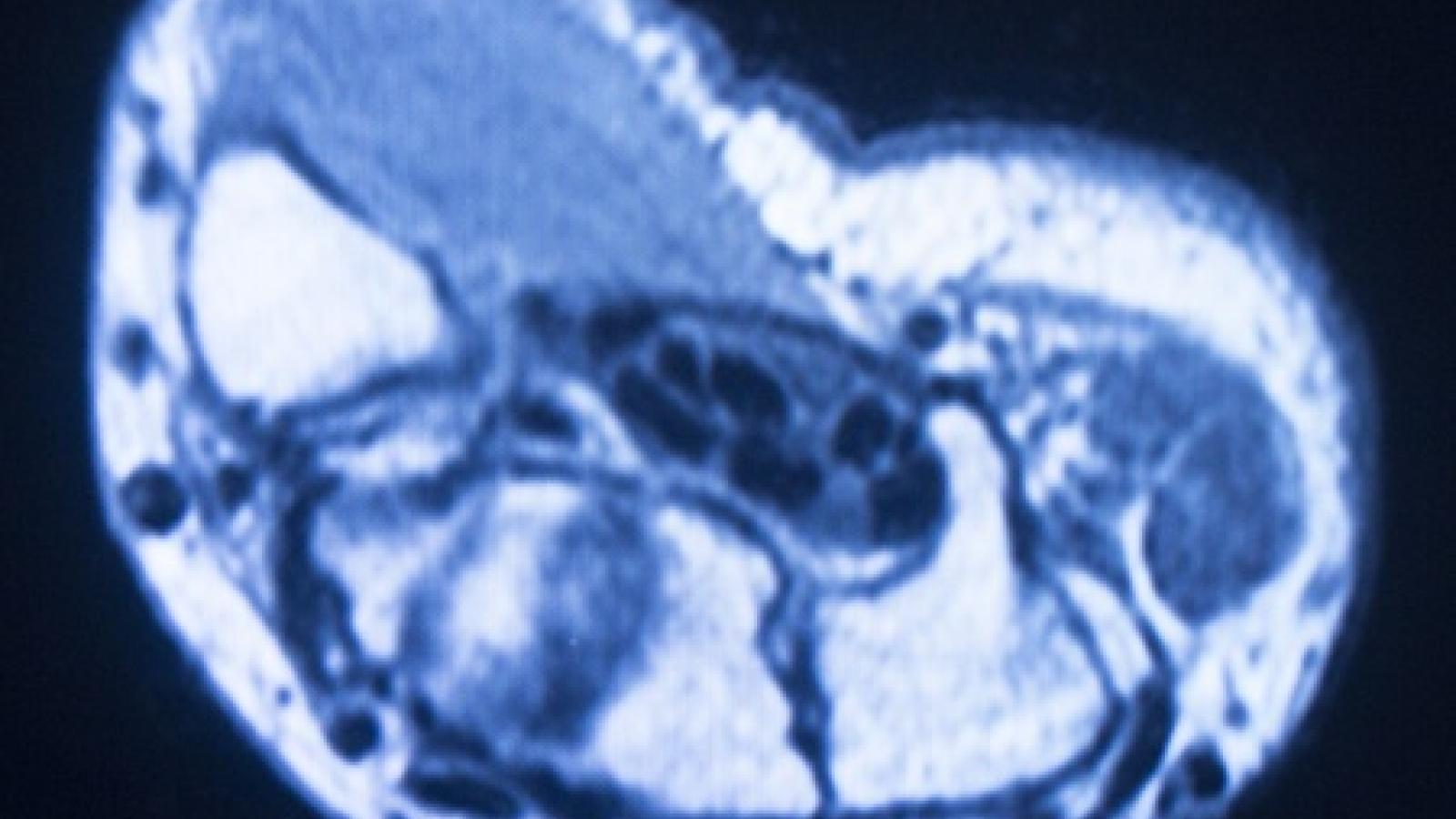 MRI%20hand.jpg