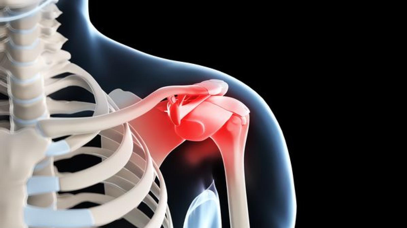 Shoulder.jpg