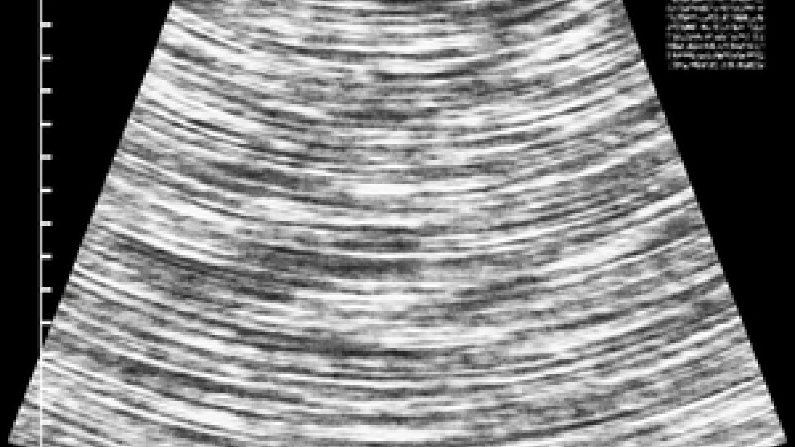Ultrasound_0.jpg