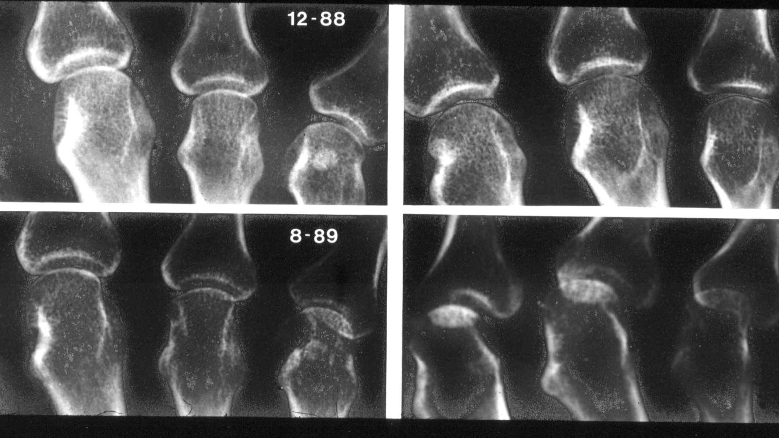 XRAYworse.jpg