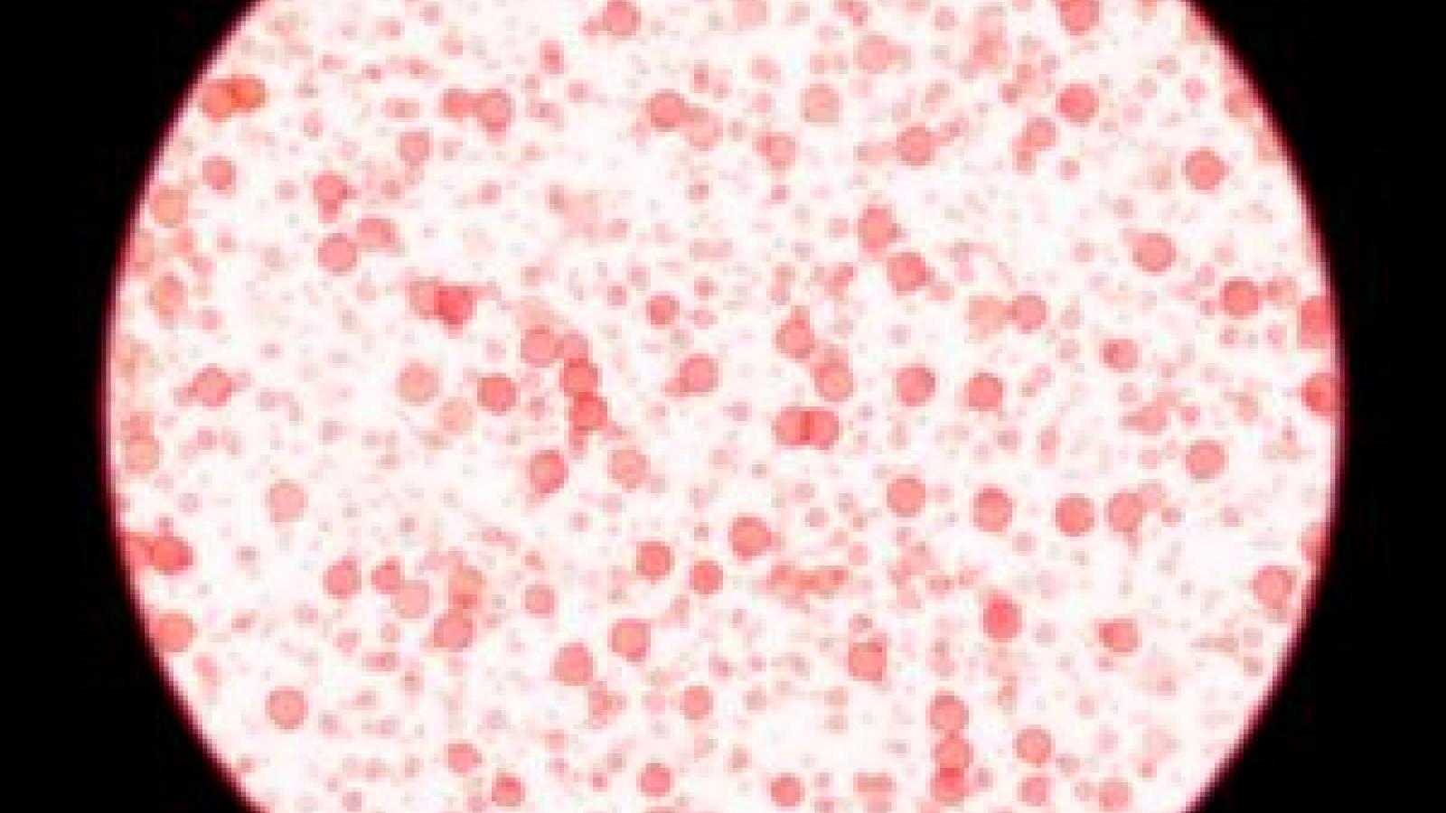 bacteria.jpg