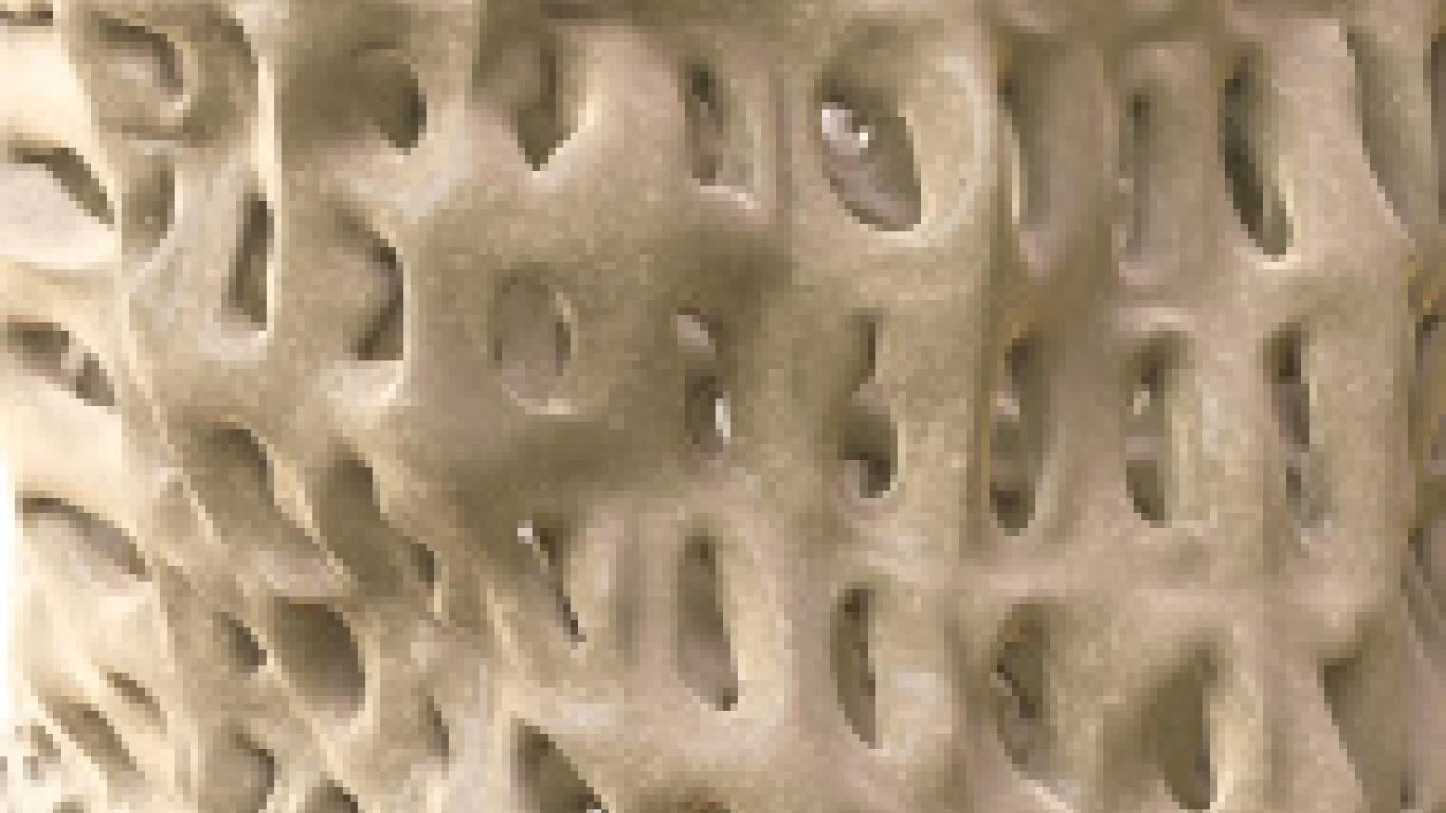 bone%20dense.jpg (keep)