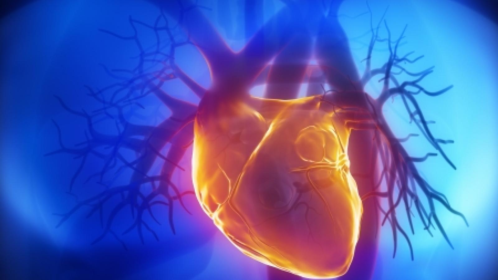 cardiac2.jpg (keep)