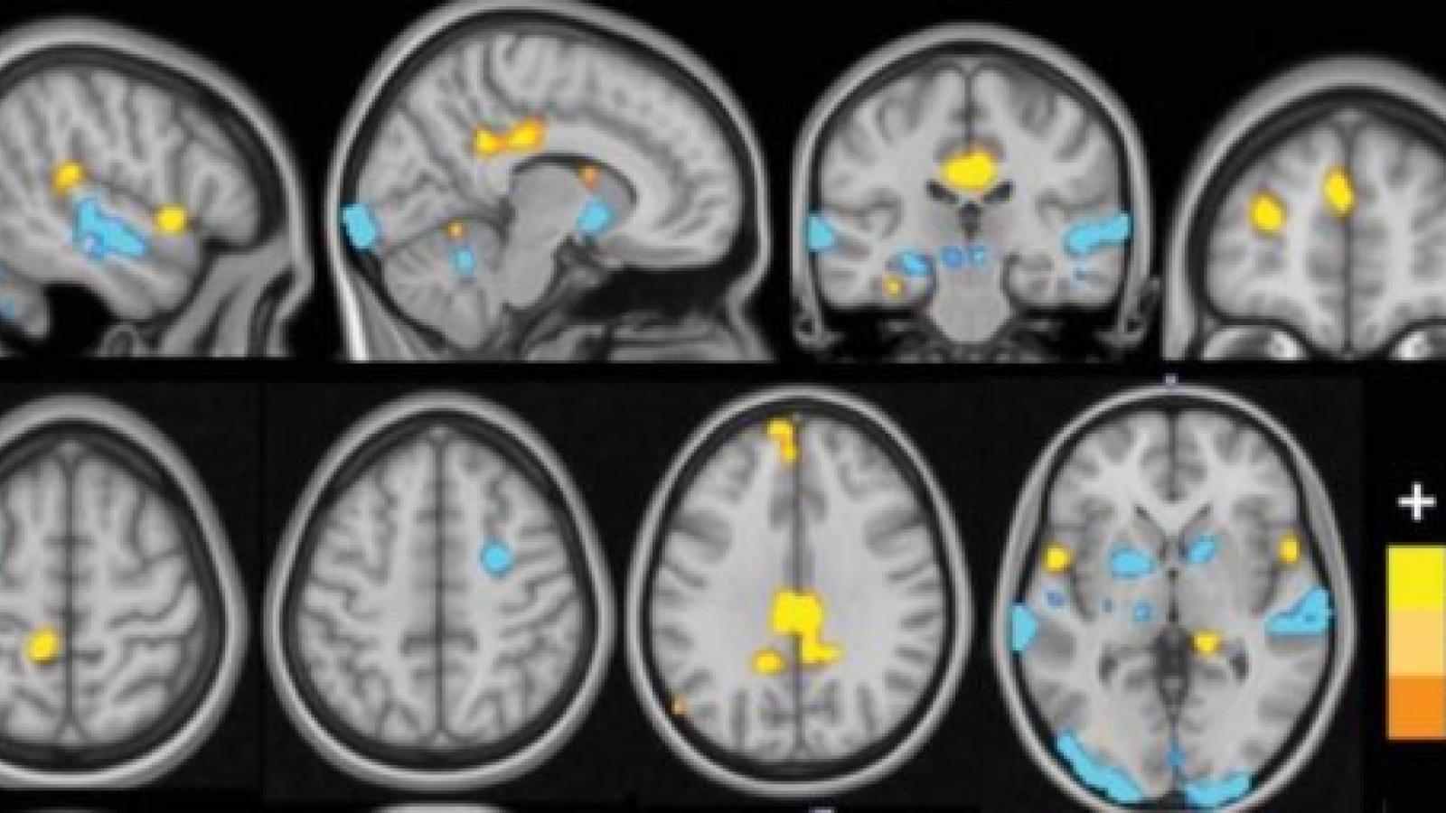fMRI.jpg