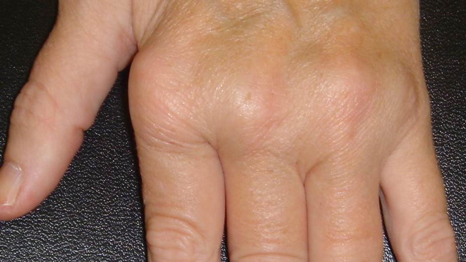 handcropped.RA_.jpg