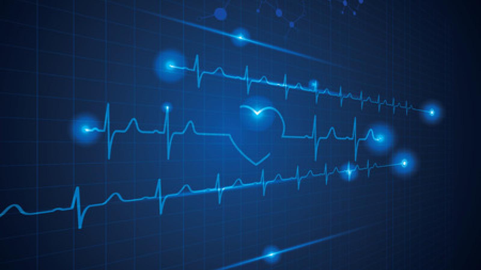 heart.EKG_.CVD_.jpg