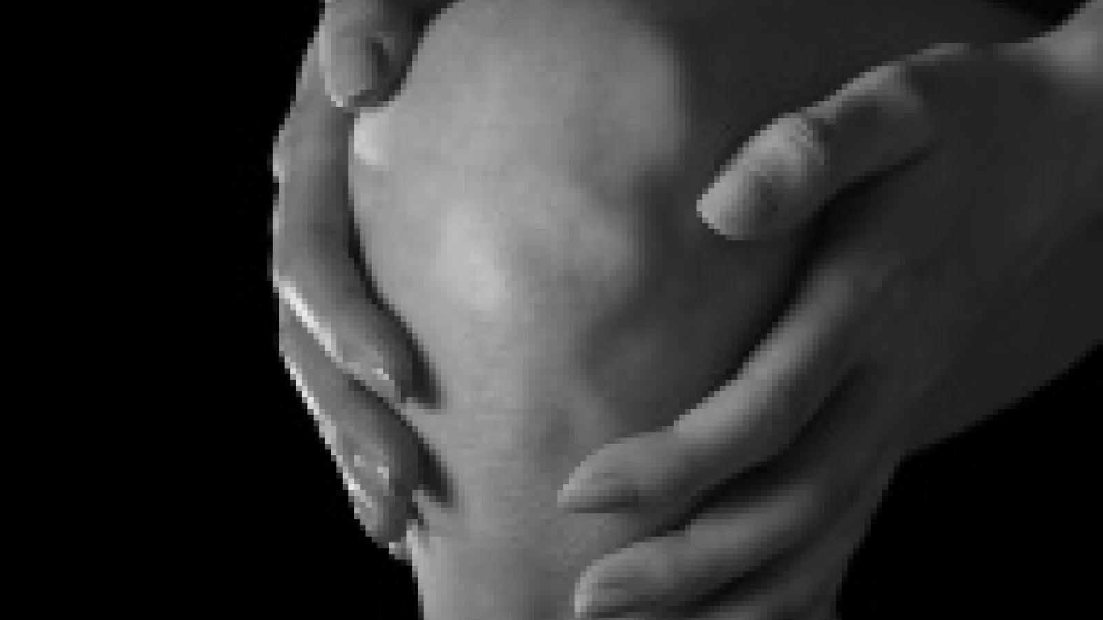 knee.oa_.jpg (keep)