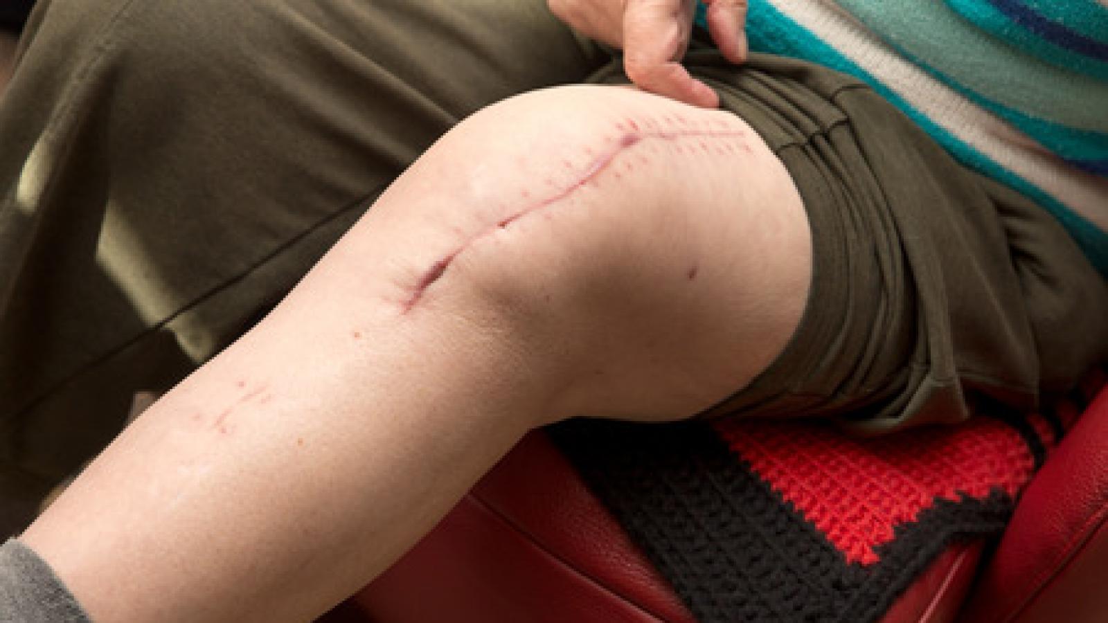 knee.surgery.jpg (keep)