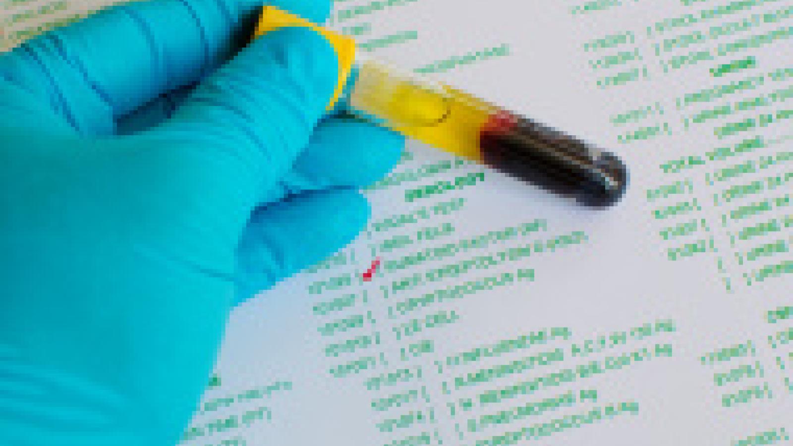 lab%20-rheumatoid-factor-testing.jpg