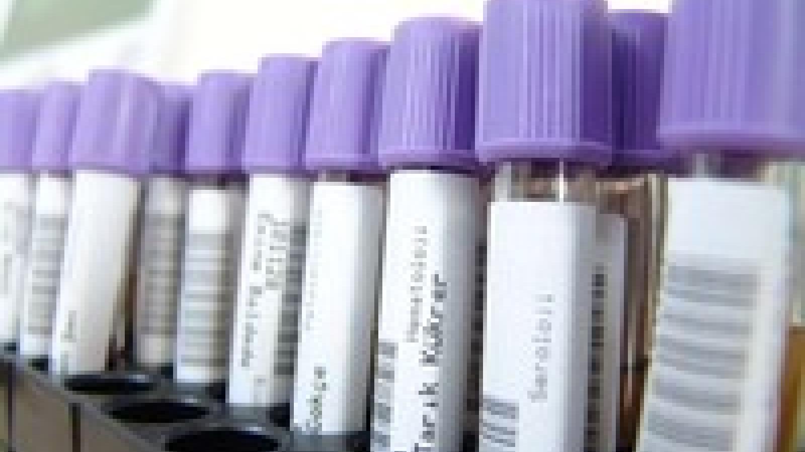 lab%20test_0.jpg