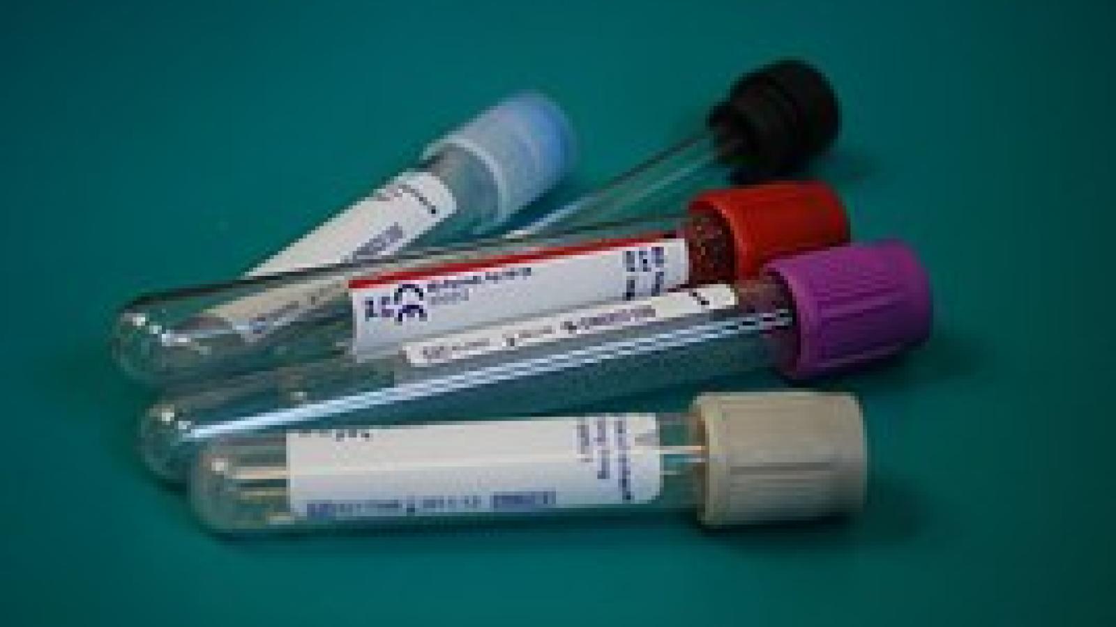 labs.tubes_.jpg