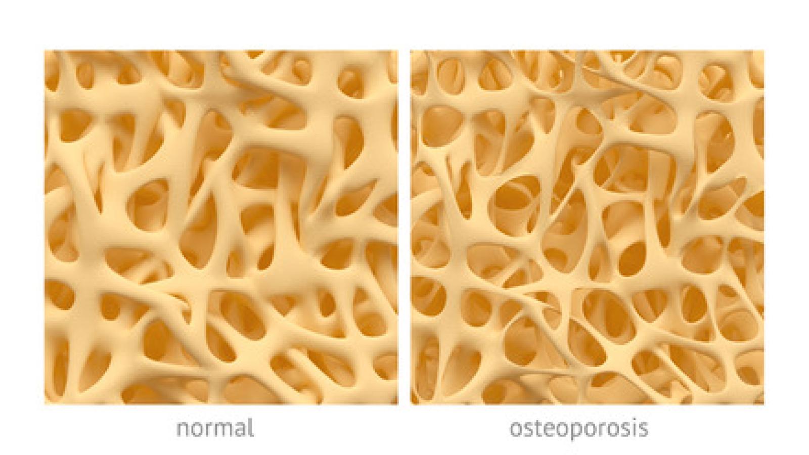 op.compare.jpg