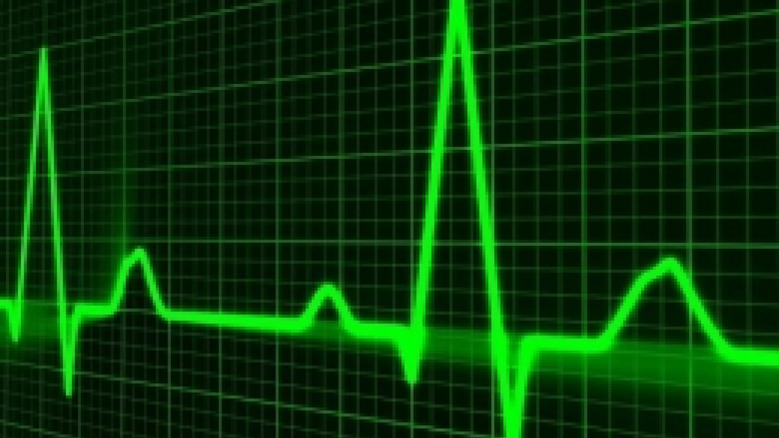 pulse-trace-163708_640.jpg