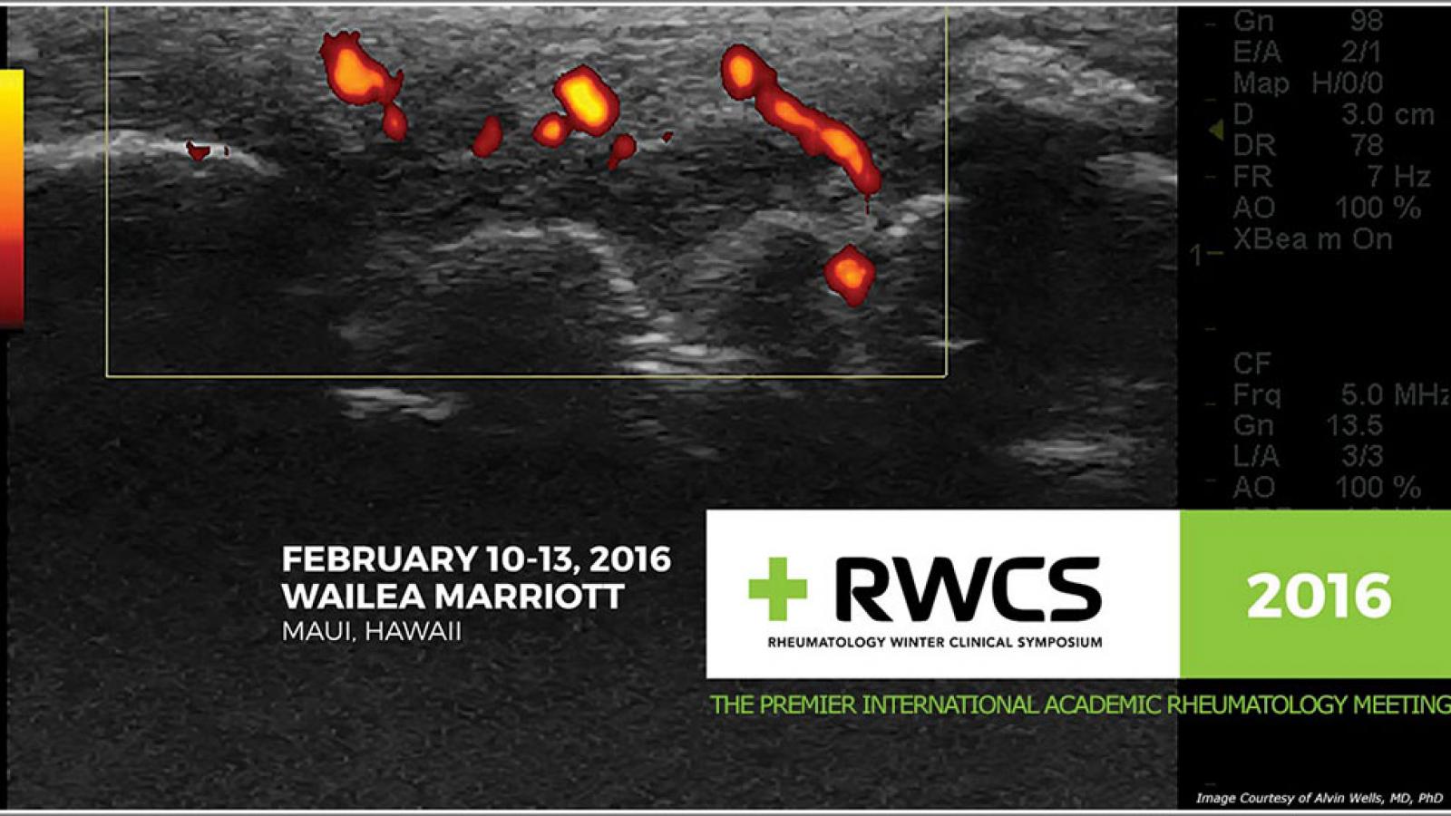 rwcs2016.jpg