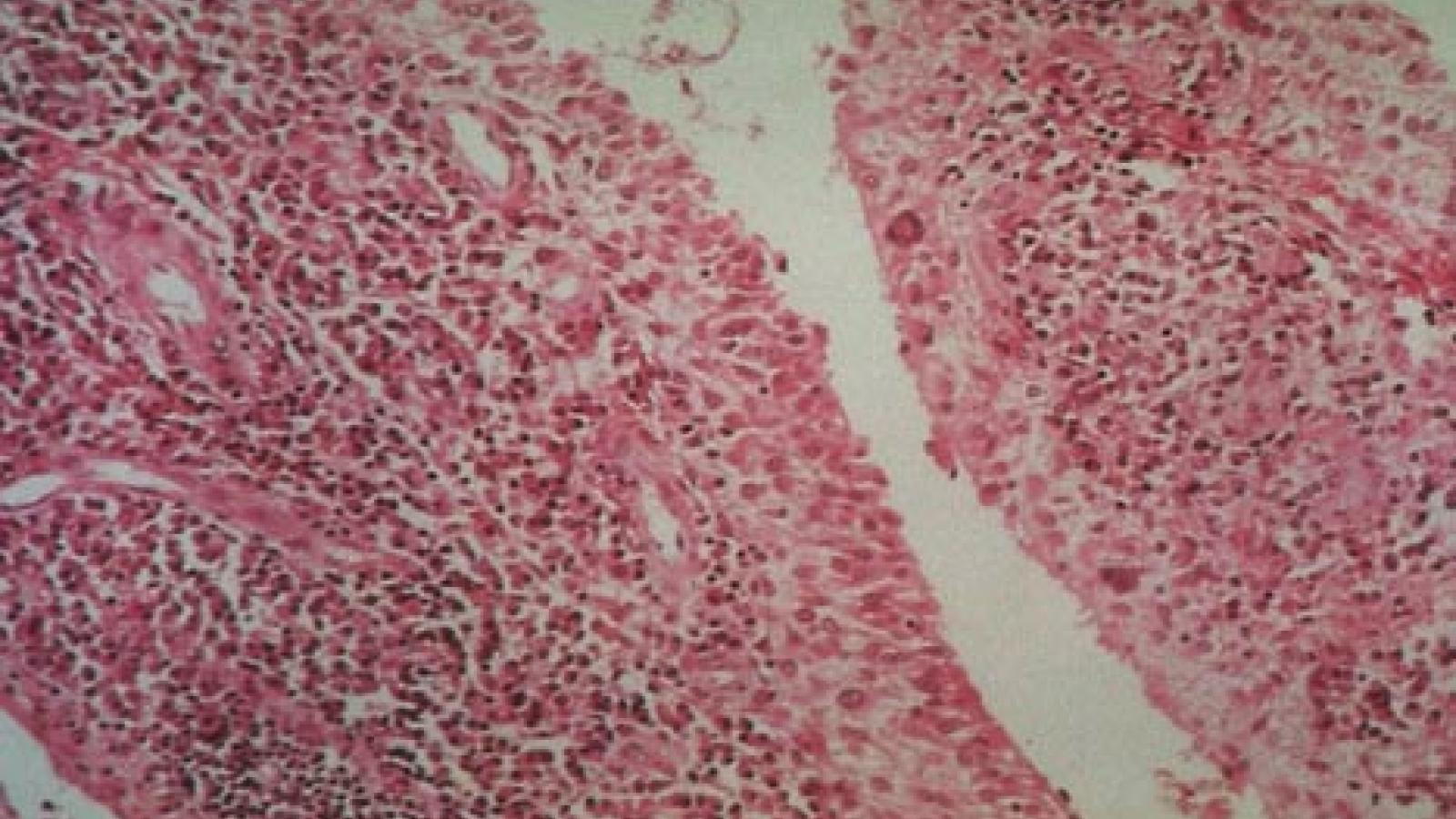 synovitis2.JPG