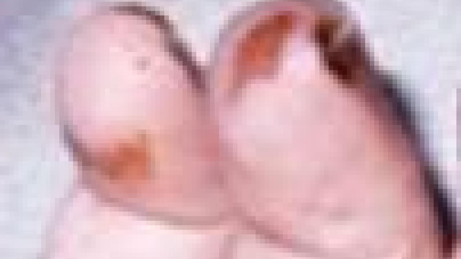 vasculitis2_0.jpg