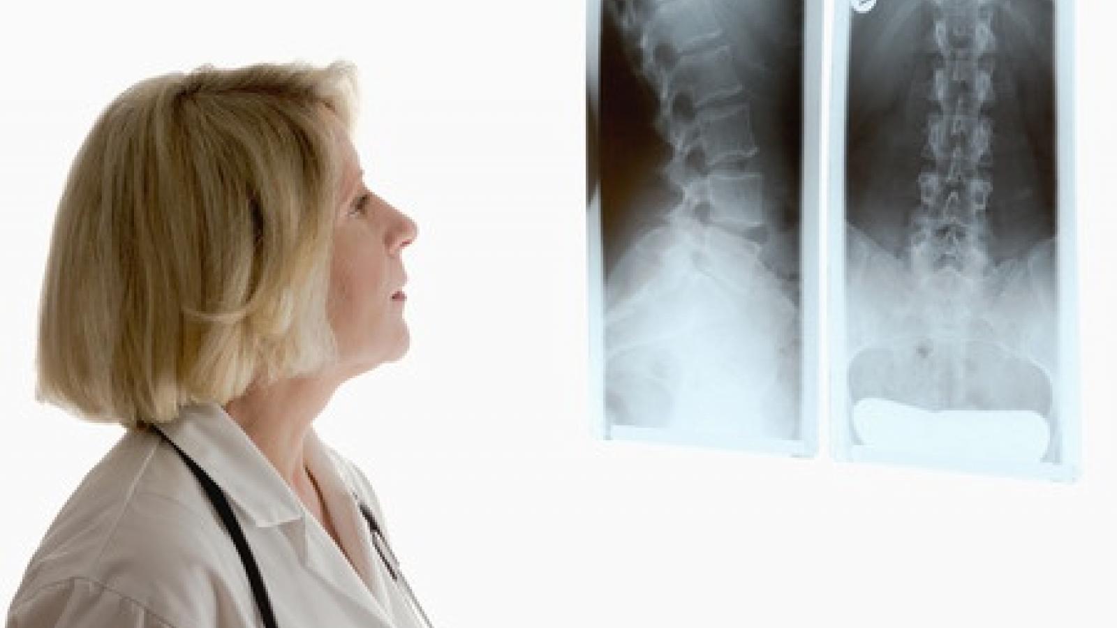xray%20spine%20films_0.jpg