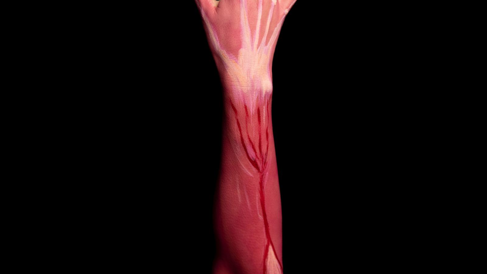 arm,muscle,weak