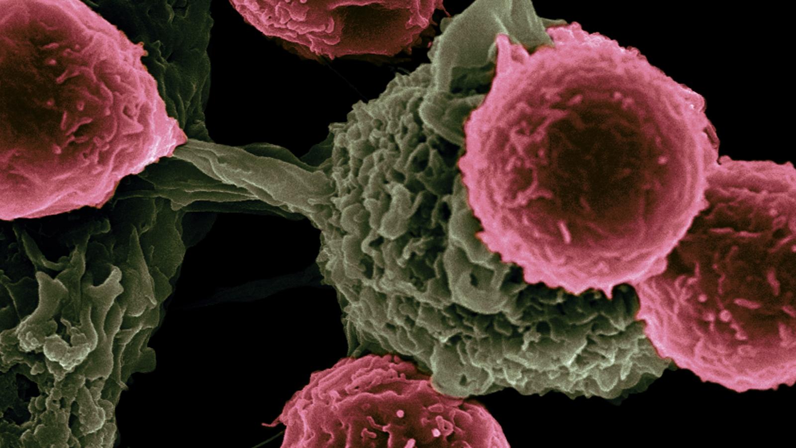 Cancer,cells