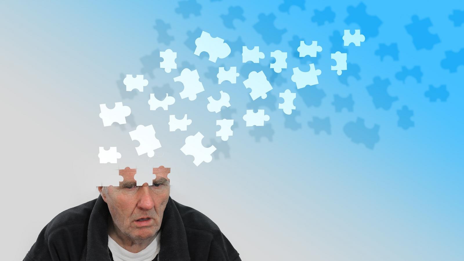 dementia,brain