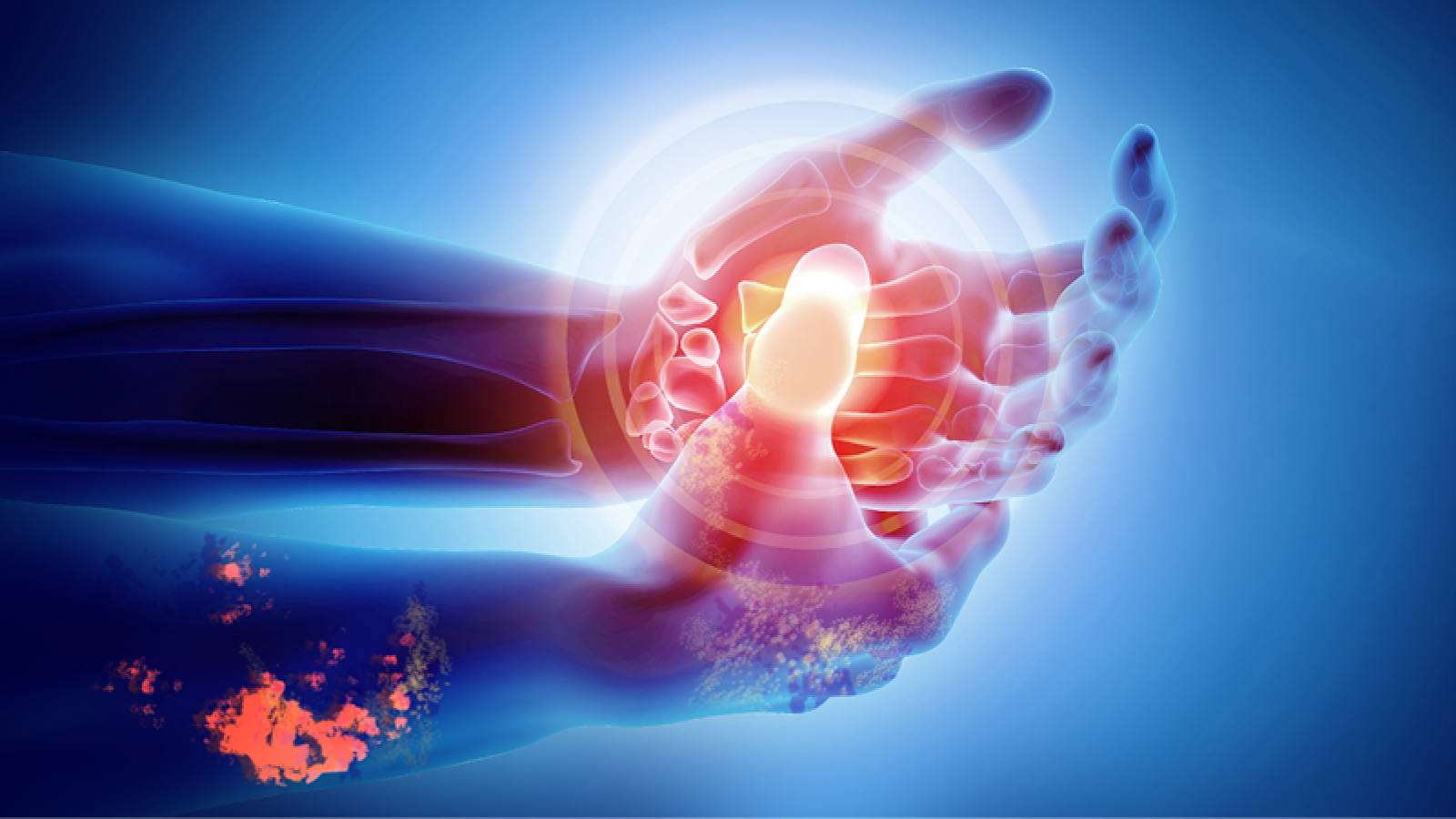 Open Palm indicating pain