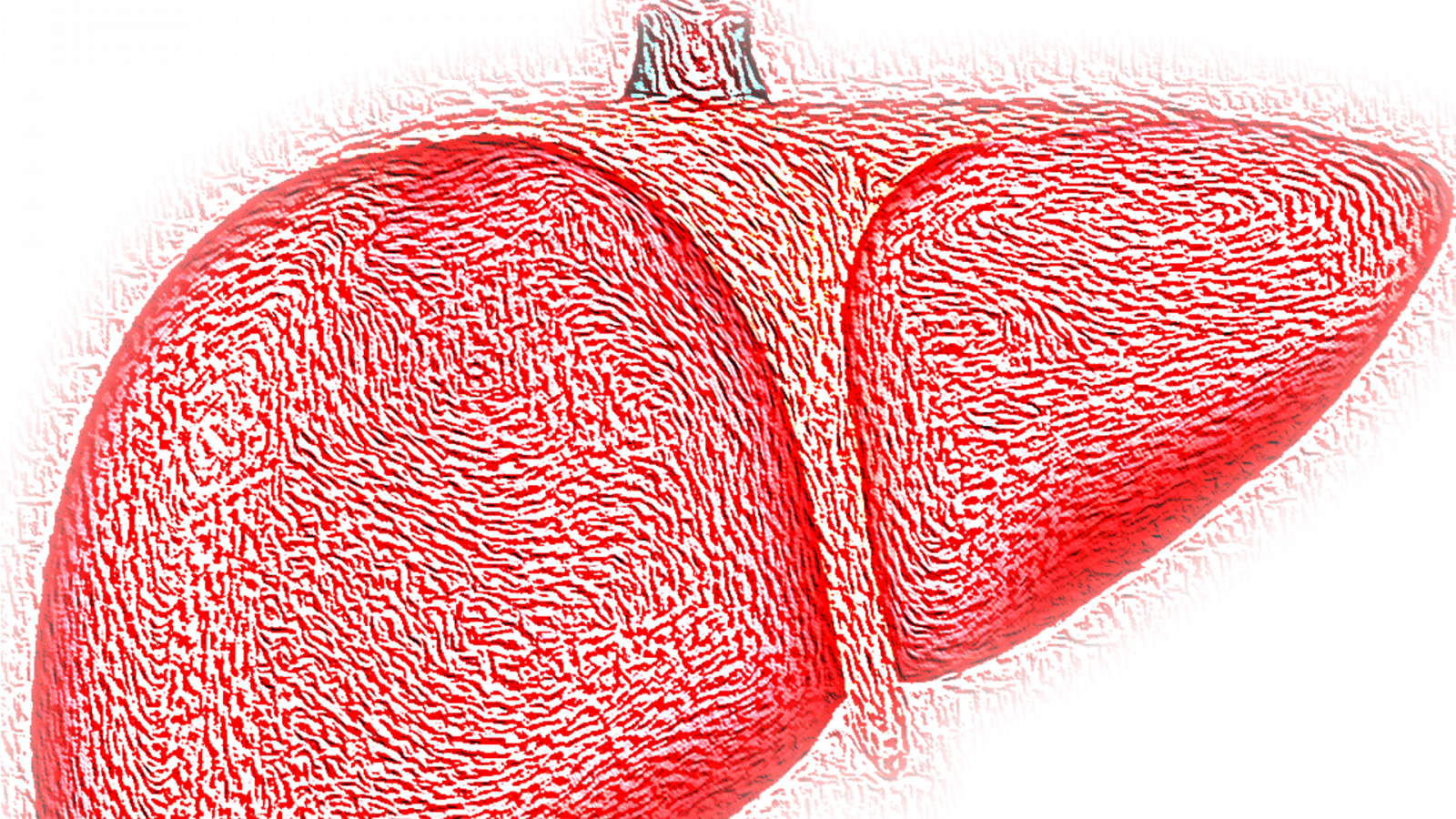 Liver,hepatic,red