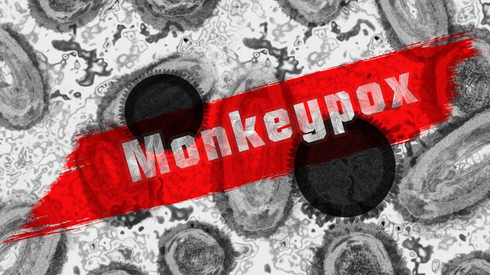 monkey,pox