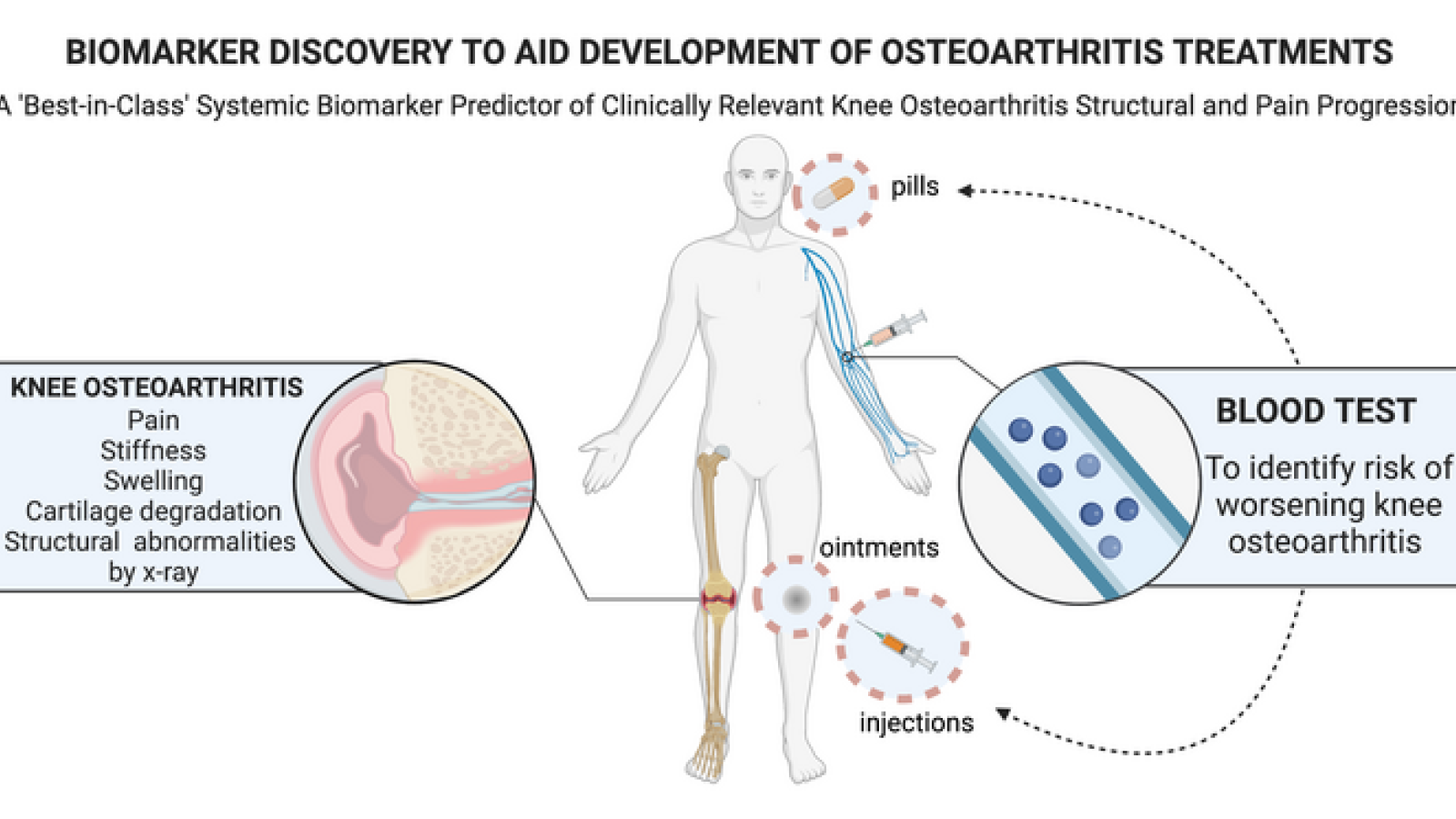 OA,biomarker