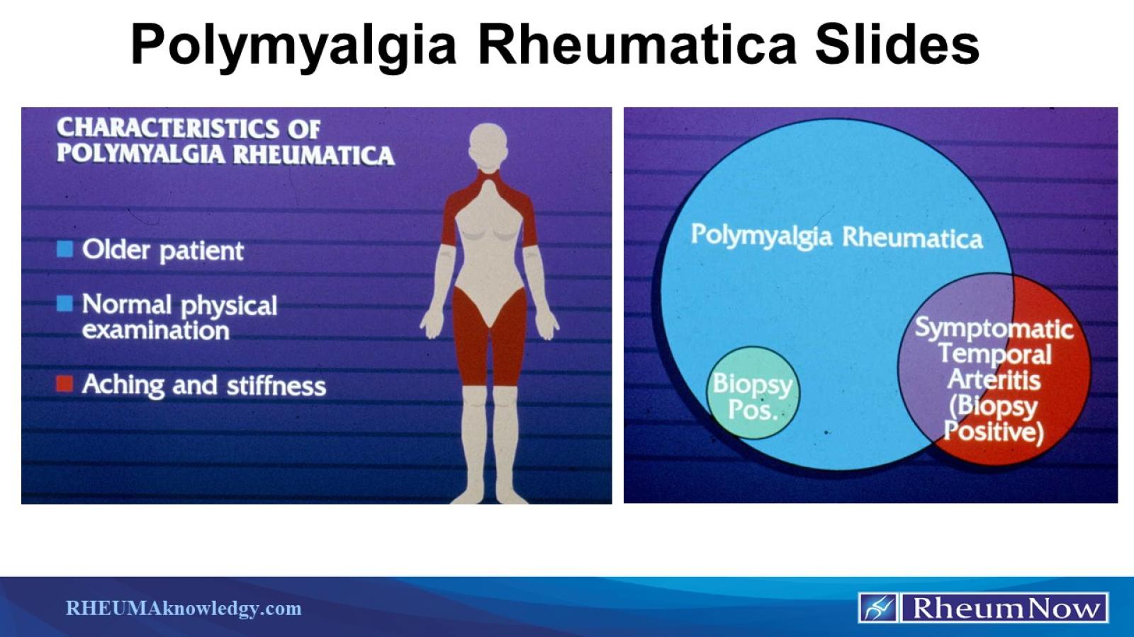 PMR,slides,clinical