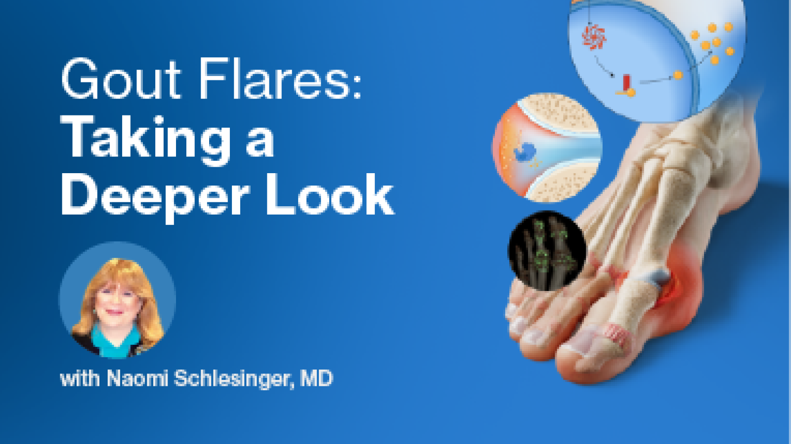 Gout RX Update