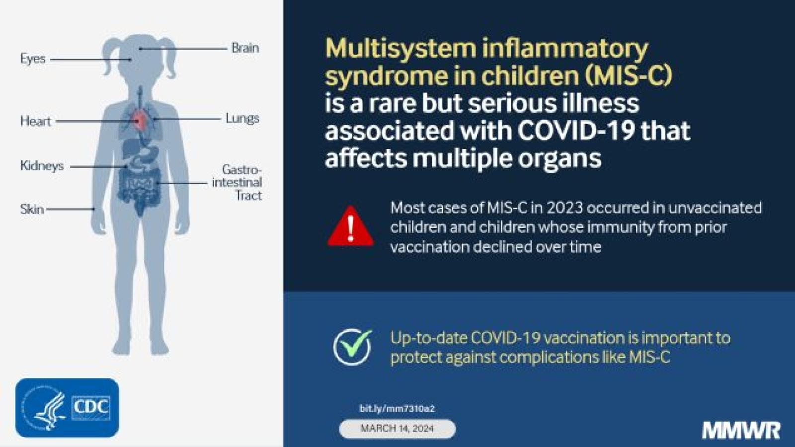 MISC,CDC
