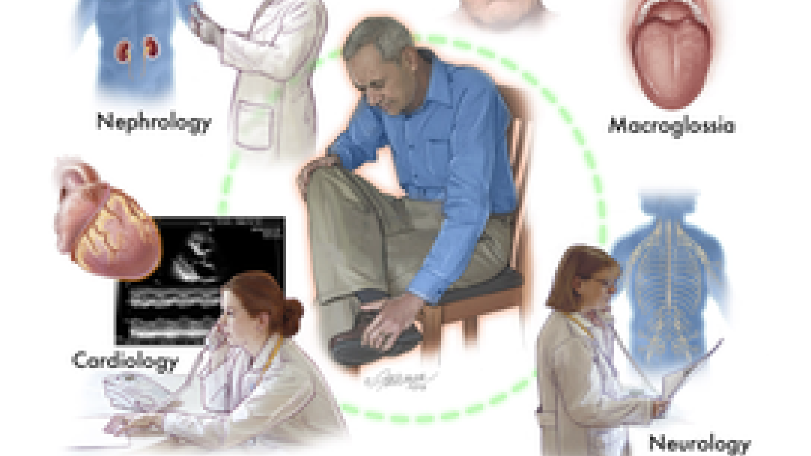 amyloidosis