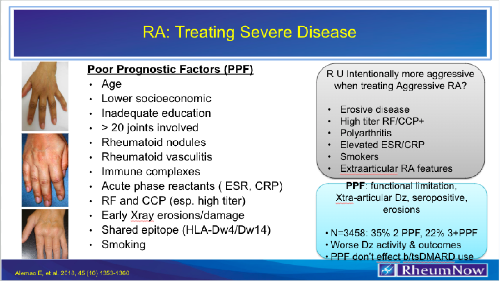 RA Treating Severe Disease DD