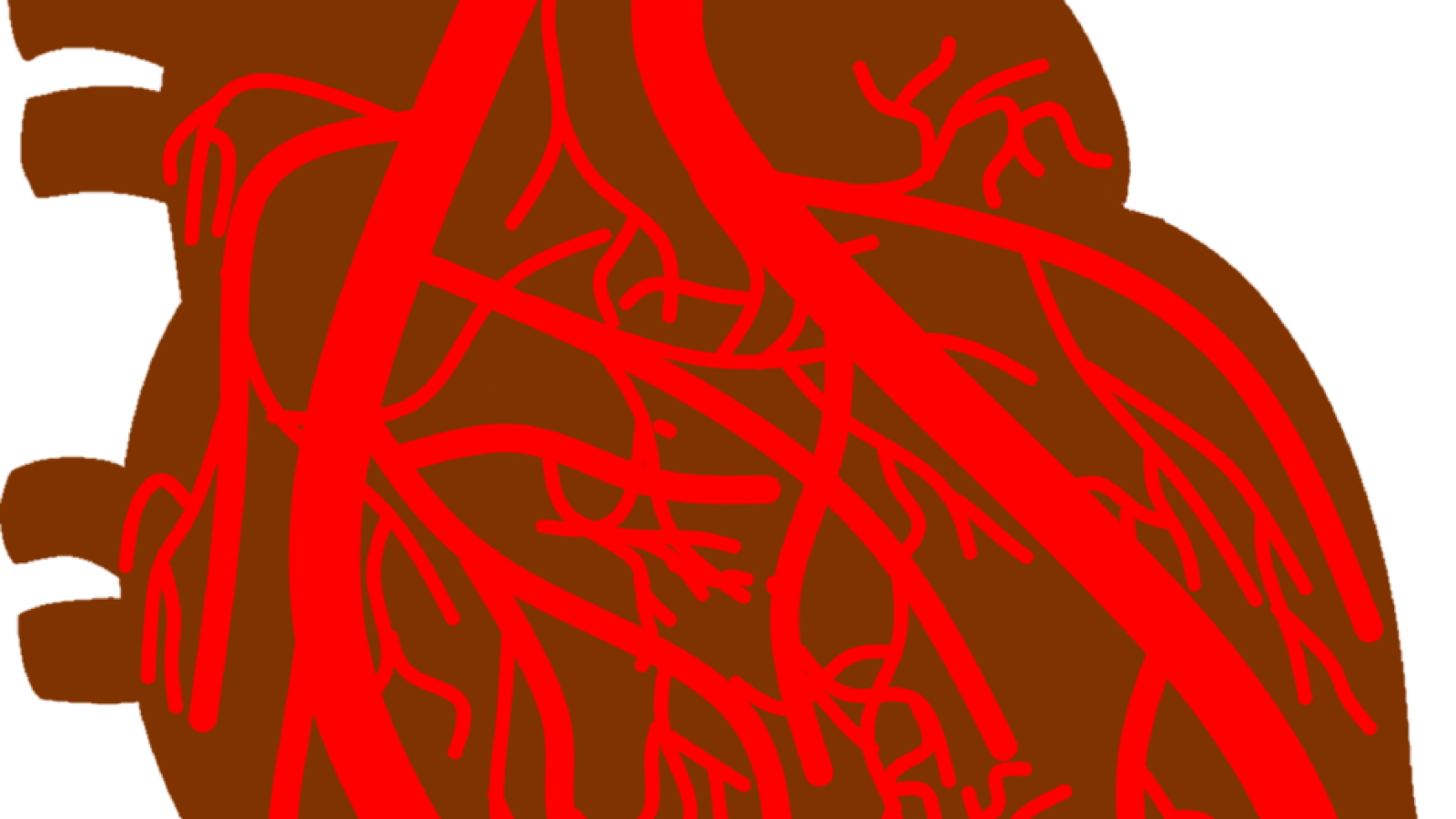 heart.coronary