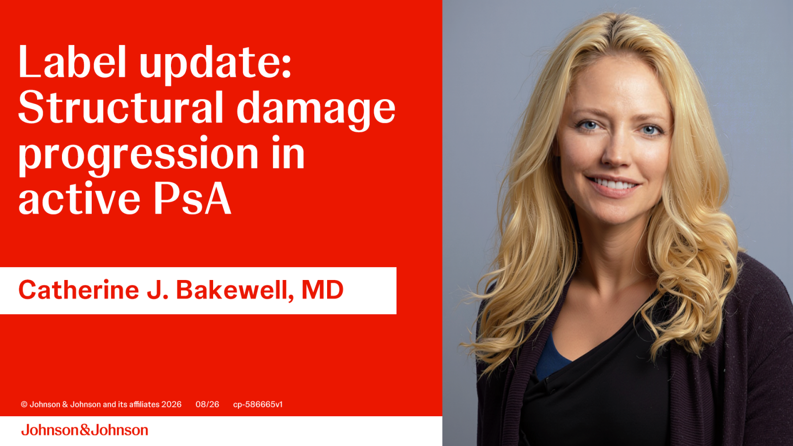 J&J RX Update